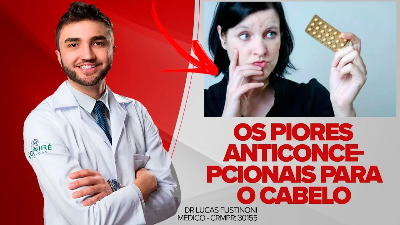 Imagem video aula doutor lucas fustinoni cabelo de mulher conheca os piores anticoncepcionais para o cabelo dr lucas fustinoni medico crmpr 30155.webp