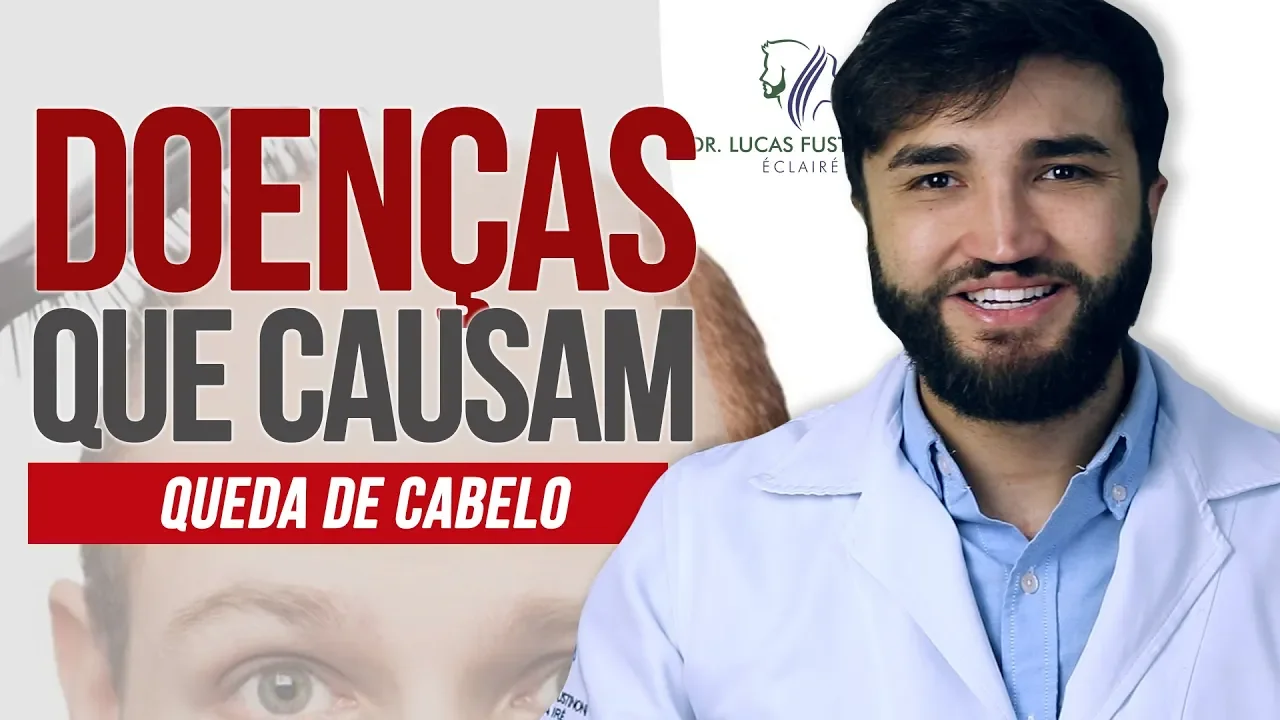 Imagem video aula doutor lucas fustinoni cabelo de mulher doencas que podem causar queda de cabelo dr lucas fustinoni.webp