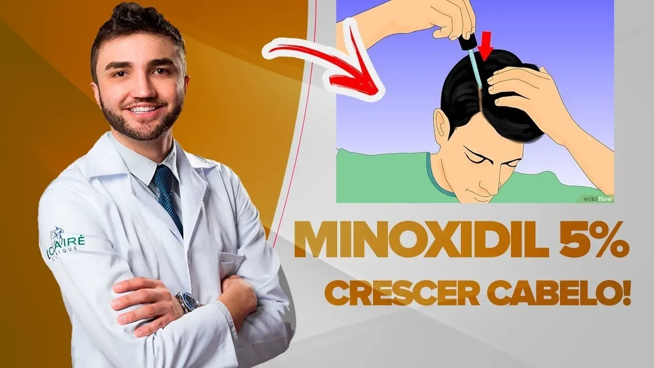 Imagem video aula doutor lucas fustinoni cabelo de mulher minoxidil 5 para crescer cabelo e barba funciona mesmo dr lucas fustinoni medico.webp