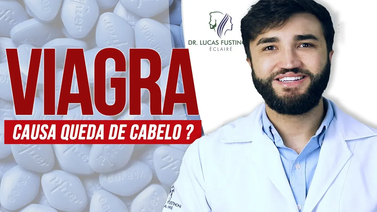 Imagem video aula doutor lucas fustinoni cabelo de mulher viagra e queda de cabelo viagra sildenafil faz o cabelo cair dr lucas fustinoni.webp