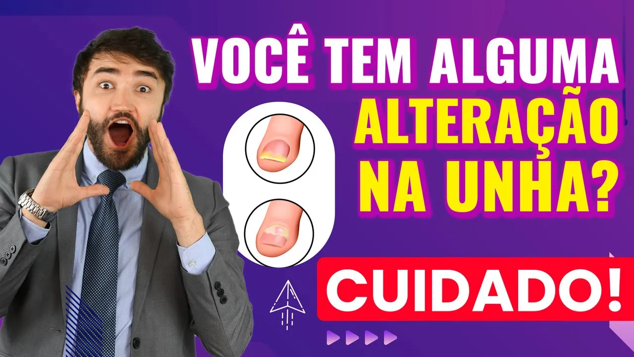 Imagem video aula doutor lucas fustinoni cuidados com cabelo a aparencia das suas unhas diz muito sobre a saude do seu cabelo.webp