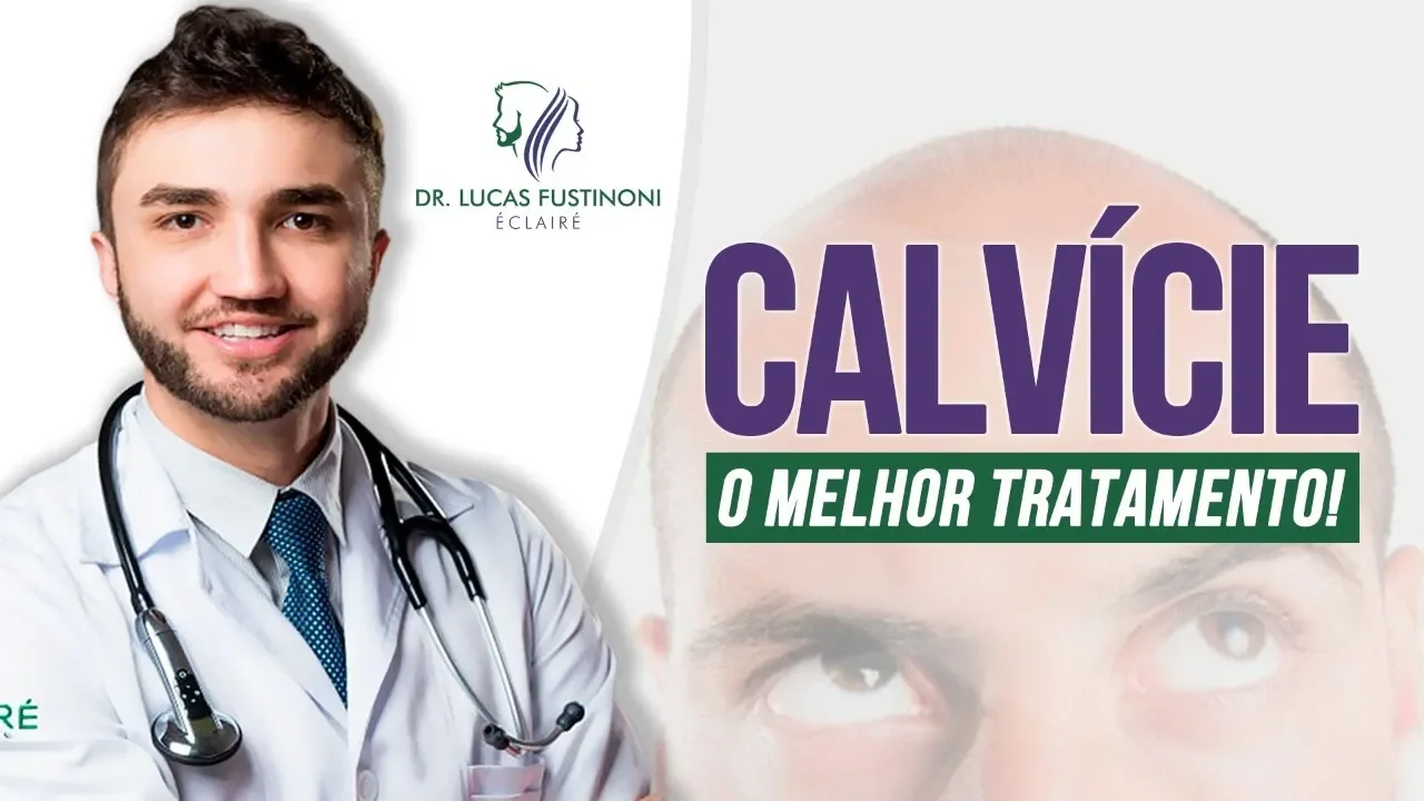 Imagem video aula doutor lucas fustinoni cuidados com cabelo calvice e queda de cabelo qual o melhor tratamento dr.webp