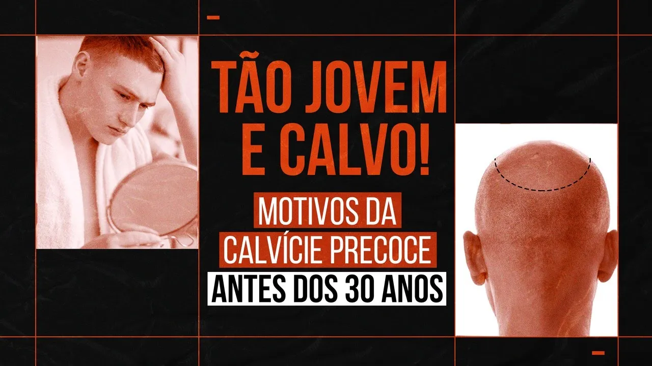 Imagem video aula doutor lucas fustinoni cuidados com cabelo calvicie precoce o que causa quais os sinais e como tratar.webp