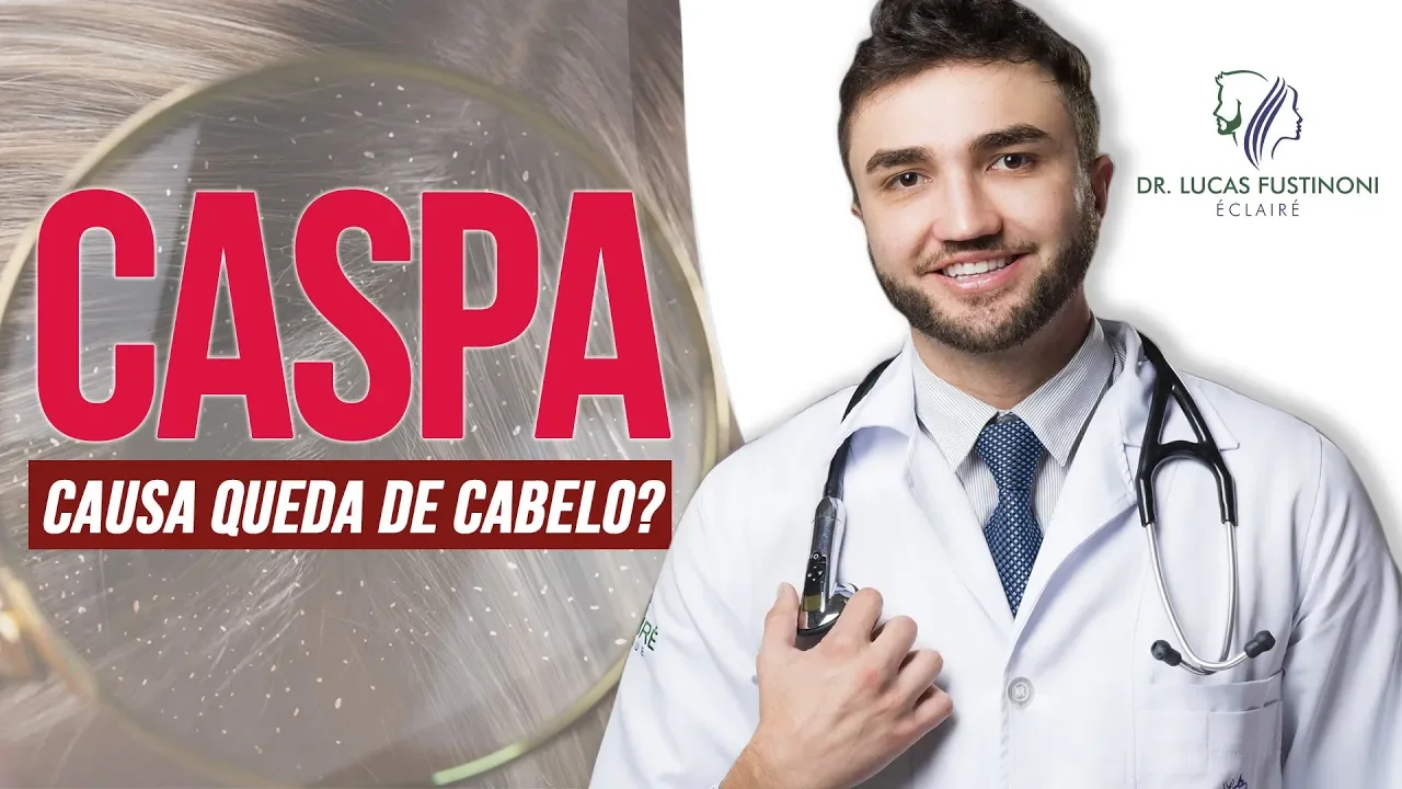 Imagem video aula doutor lucas fustinoni cuidados com cabelo caspa causa queda de cabelo dr.webp