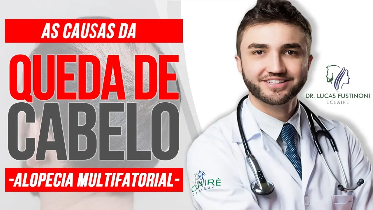 Imagem video aula doutor lucas fustinoni cuidados com cabelo causas da alopecia multifatorial queda de cabelo dr.webp