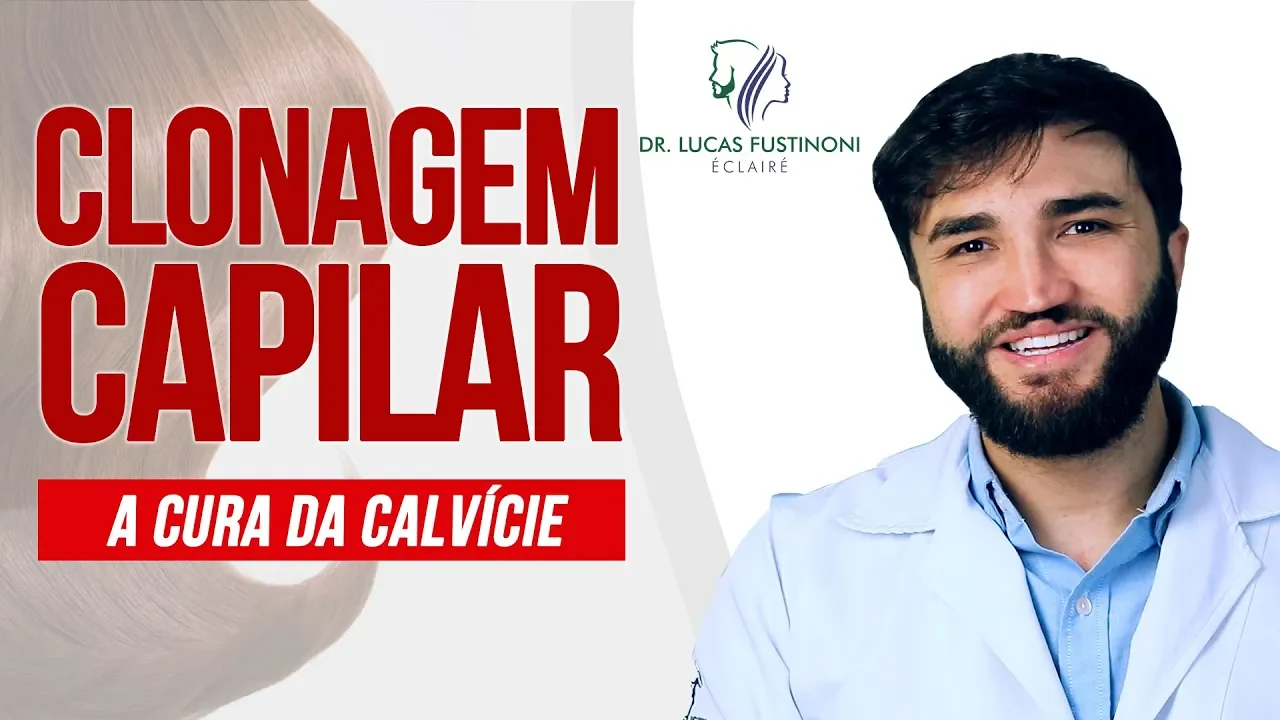 Imagem video aula doutor lucas fustinoni cuidados com cabelo clonagem capilar e a cura da calvicie e da queda de cabelo dr.webp