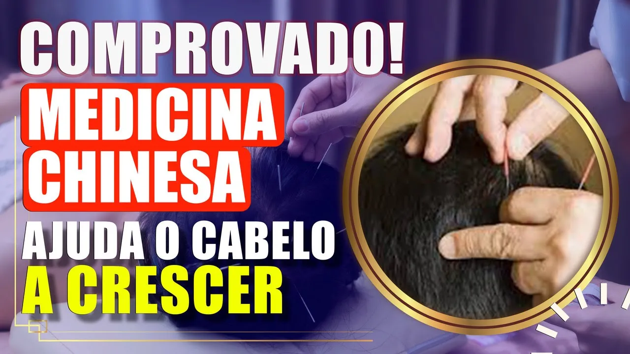 Imagem video aula doutor lucas fustinoni cuidados com cabelo como a acupuntura ajuda no tratamento da calvicie e da queda capilar.webp