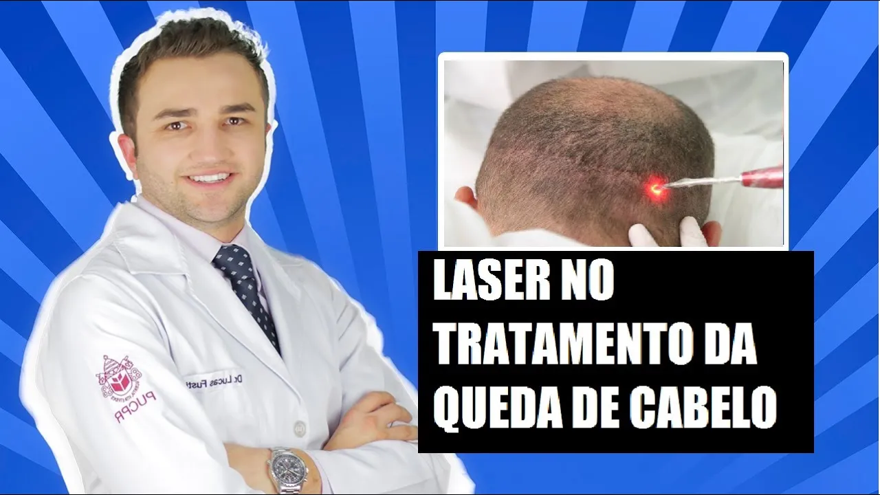 Imagem video aula doutor lucas fustinoni cuidados com cabelo laser no tratamento da queda de cabelo dr.webp