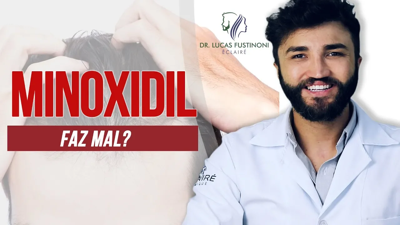 Imagem video aula doutor lucas fustinoni cuidados com cabelo minoxidil faz mal e perigoso dr.webp
