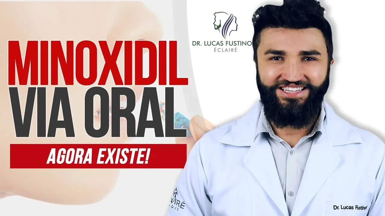 Imagem video aula doutor lucas fustinoni cuidados com cabelo minoxidil oral tomar minoxidil e melhor do que passar dr.webp