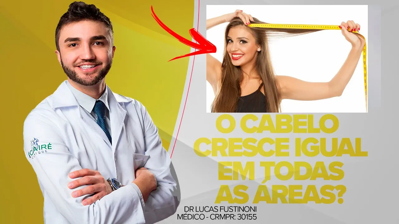 Imagem video aula doutor lucas fustinoni cuidados com cabelo o cabelo cresce igualmente em todas as areas da cabeca dr medico crmpr 30155.webp