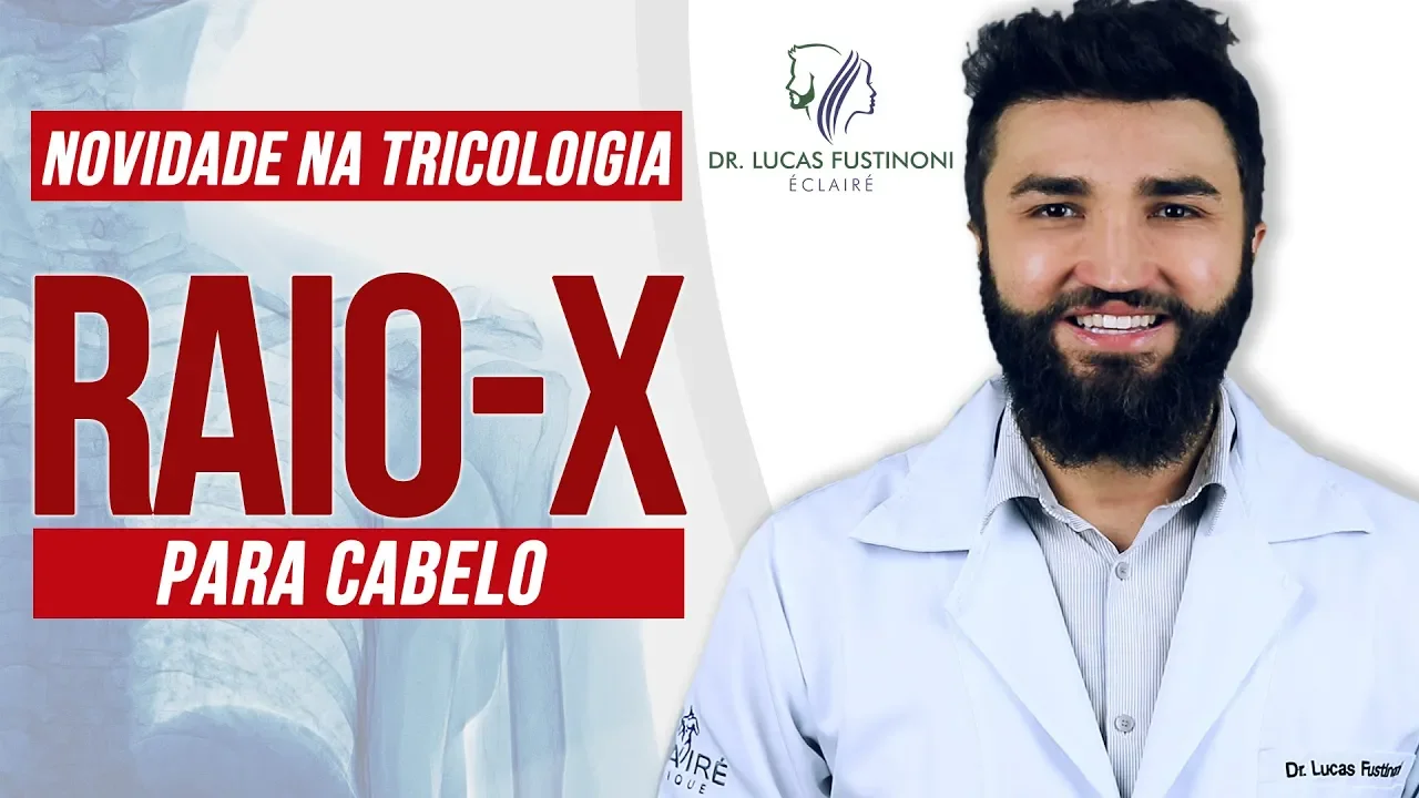 Imagem video aula doutor lucas fustinoni cuidados com cabelo raio x para cabelo as novidades na avaliacao capilar da tricologia dr.webp