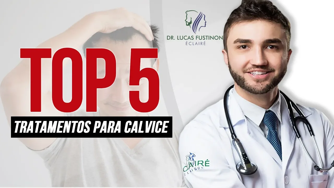 Imagem video aula doutor lucas fustinoni cuidados com cabelo top 5 melhores tratamentos para calvice dr.webp