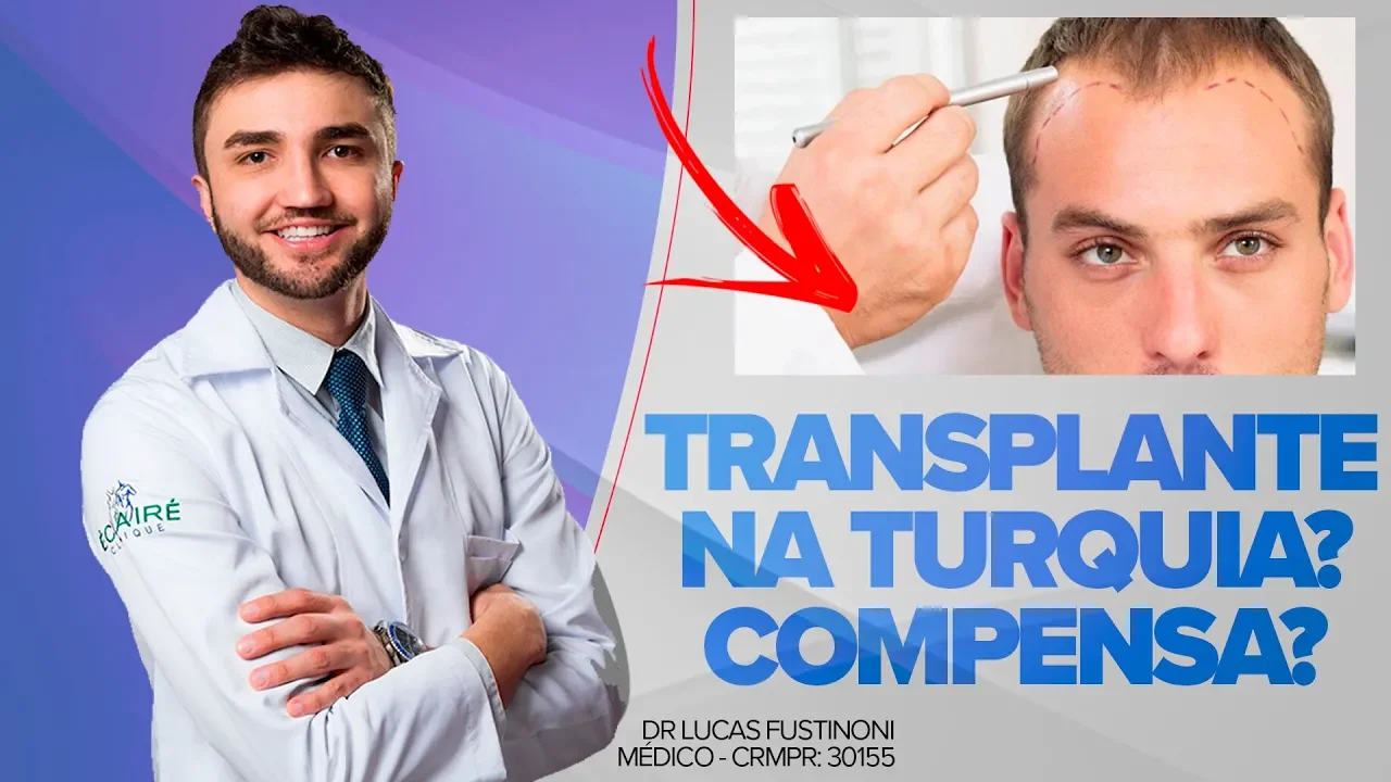 Imagem video aula doutor lucas fustinoni cuidados com cabelo transplante na turquia compensa e confiavel dr medico crmpr 30155.webp