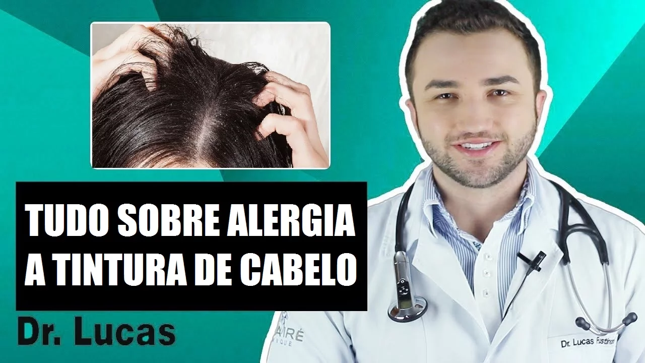 Imagem video aula doutor lucas fustinoni cuidados com cabelo tudo sobre alergia a tintura de cabelos dr.webp
