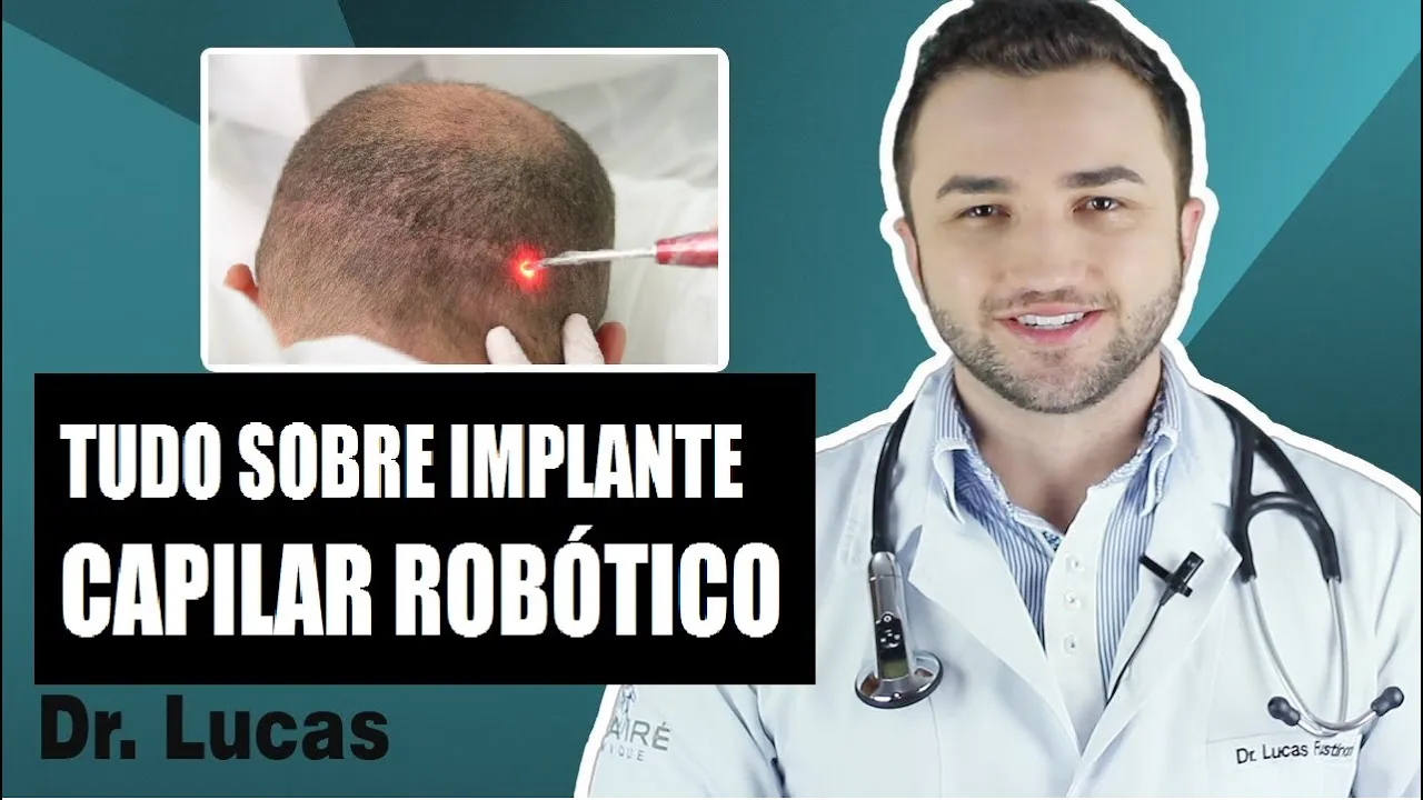 Imagem video aula doutor lucas fustinoni cuidados com cabelo tudo sobre implante capilar robotico dr.webp