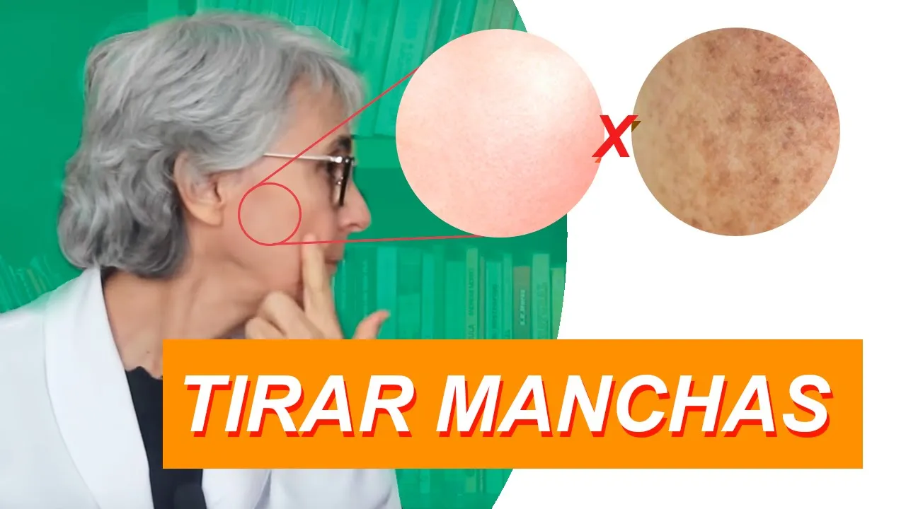 Imagem video aula doutora angela xavier saude tratamentos acabe com as manchas de pele inclusive melasma.webp