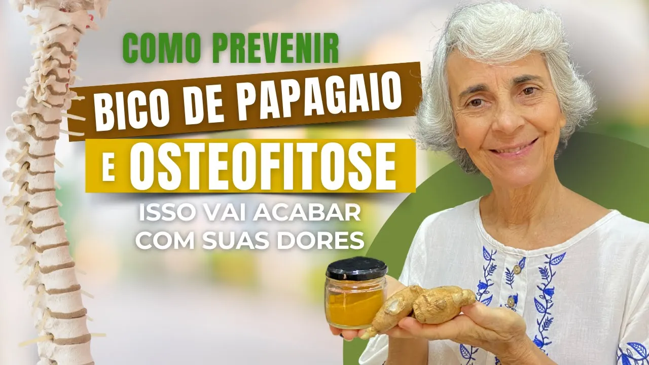 Imagem video aula doutora angela xavier saude tratamentos como prevenir o bico de papagaio e a osteofitose.webp