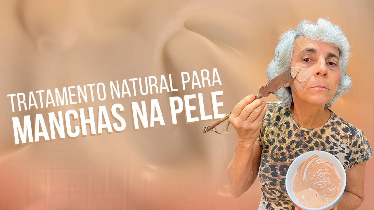 Imagem video aula doutora angela xavier saude tratamentos elimine manchas na pele com este tratamento natural eficaz.webp