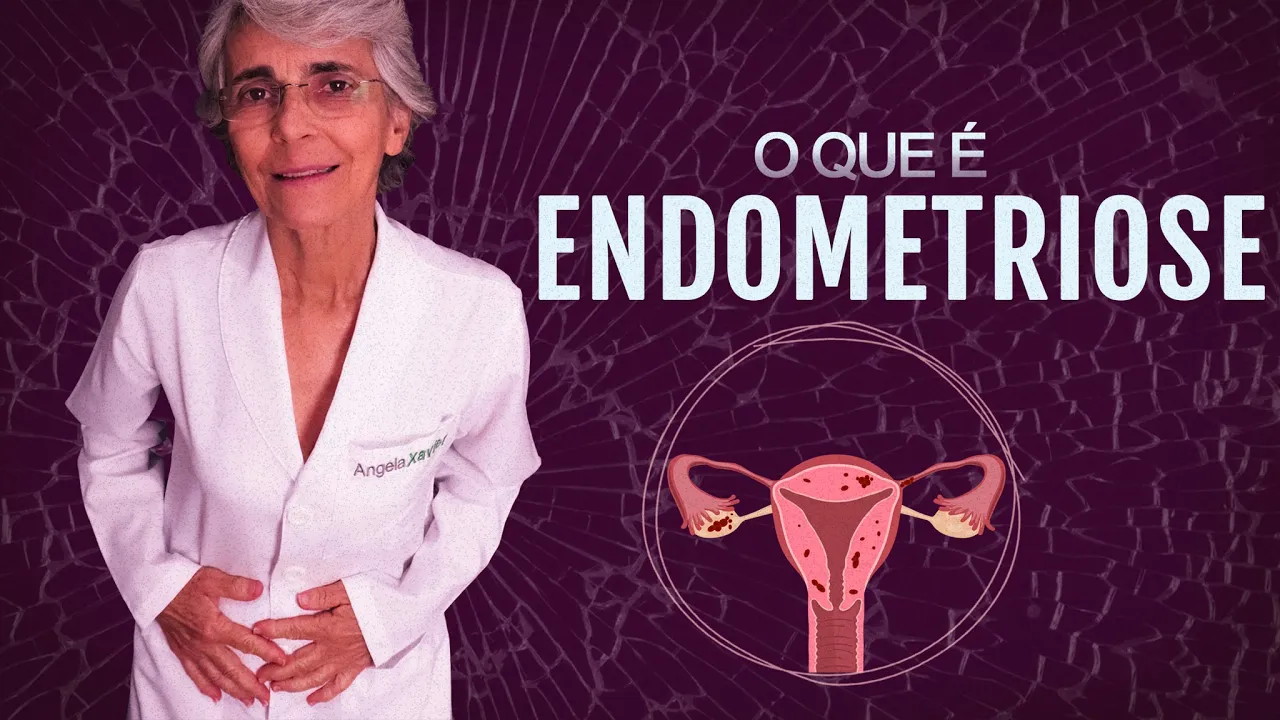 Imagem video aula doutora angela xavier saude tratamentos endometriose o que e e o que fazer.webp