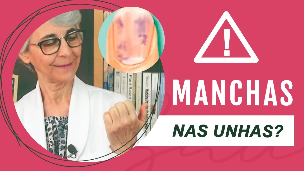 Imagem video aula doutora angela xavier saude tratamentos manchas nas unhas ligue o sinal de alerta.webp