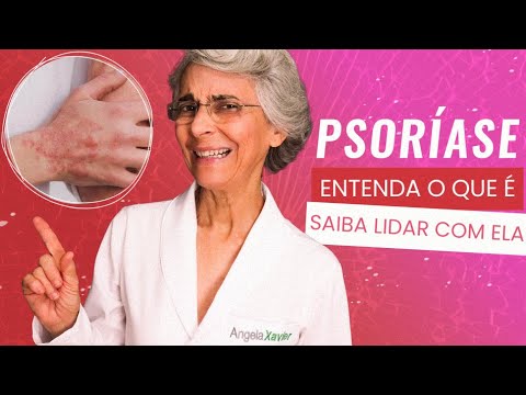 Imagem video aula doutora angela xavier saude tratamentos psoriase entenda o que e e saiba lidar com ela.webp