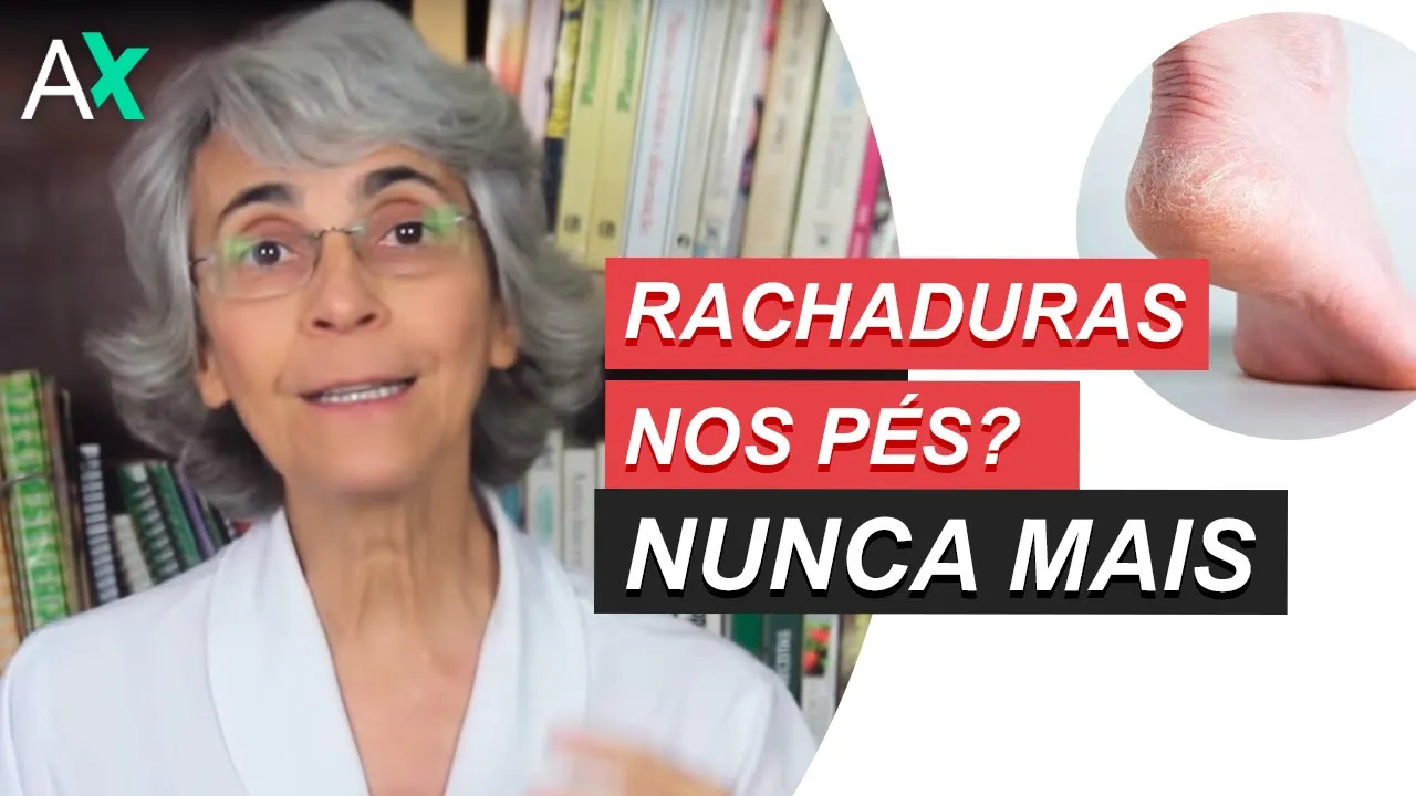 Imagem video aula doutora angela xavier saude tratamentos rachaduras nos pes nunca mais.webp