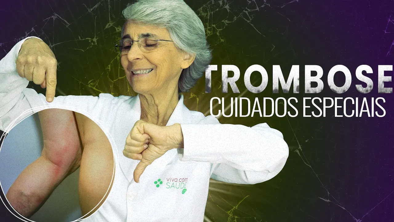 Imagem video aula doutora angela xavier saude tratamentos sinais de que voce pode estar com trombose.webp