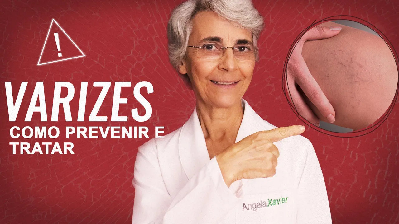 Imagem video aula doutora angela xavier saude tratamentos varizes causas prevencao e como reverter.webp