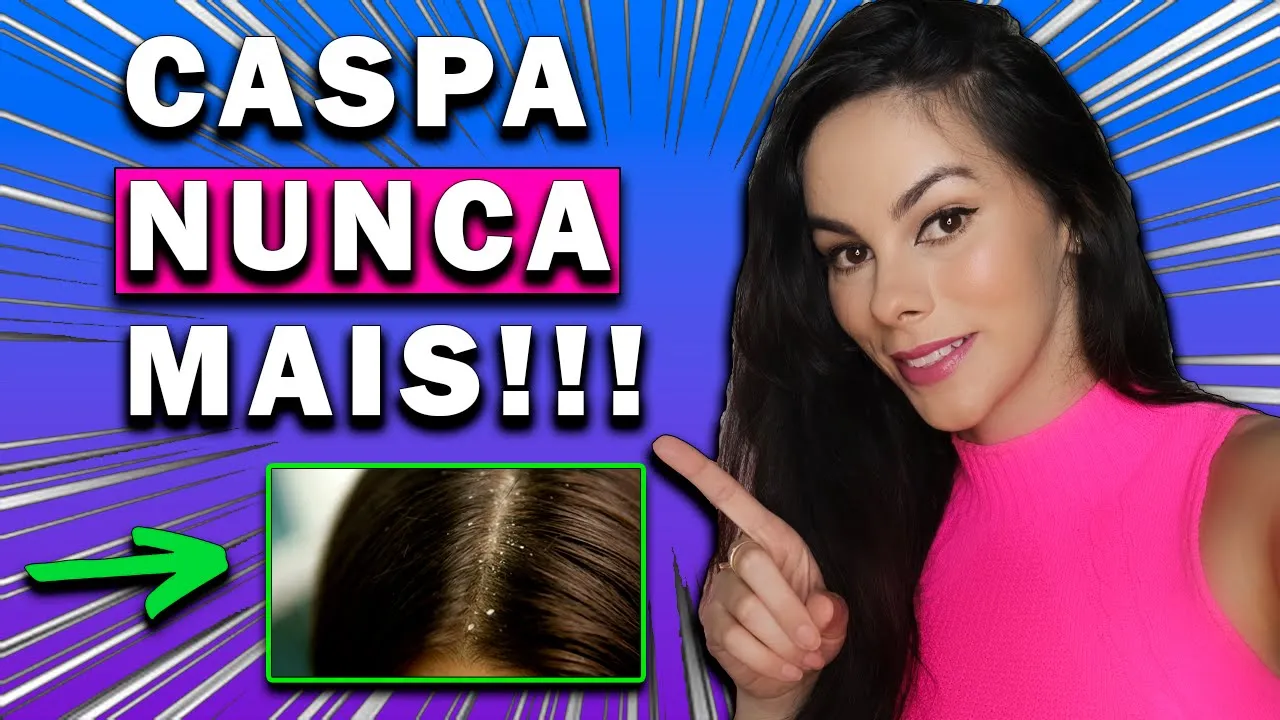 Imagem video aula elisa miranda cabelo acabe com a caspa para sempre shampoos remedios e dicas para acabar com a caspa de forma eficaz.webp